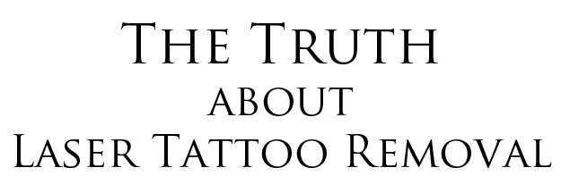 Laser Tattoo Removal: Everything You Need to Know - SD Botox